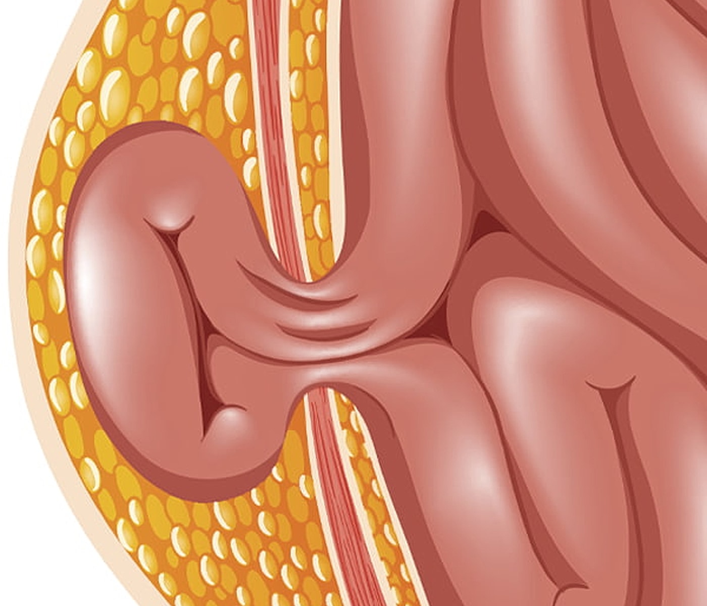 Anatomical illustration of human fat tissue and muscle.