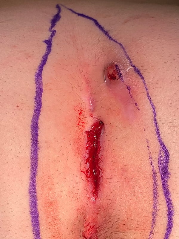 Gallery Before & After